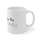 “You Are Beautiful”, Ceramic Mugs (11oz\15oz\20oz)
